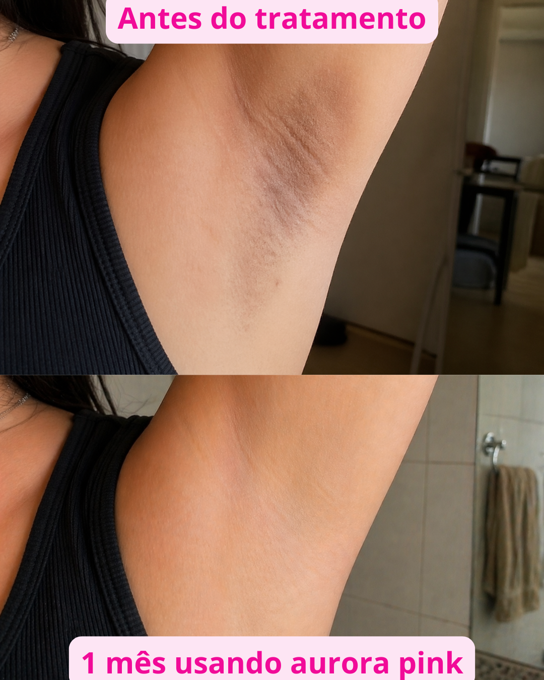 Antes e Depois
